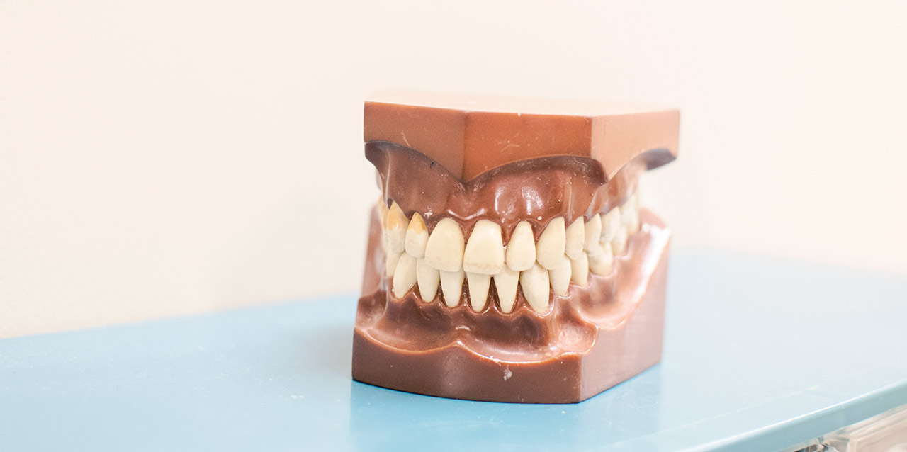 prótese dentária de amostra